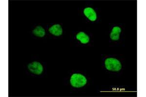 Immunofluorescence of purified MaxPab antibody to MCM4 on HeLa cell. (MCM4 anticorps  (AA 1-863))
