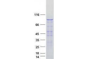 Validation with Western Blot