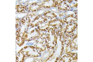 Immunohistochemistry of paraffin-embedded Mouse kidney using TR antibody (ABIN1683134, ABIN5664756, ABIN5664758 and ABIN6220605) at dilution of 1:100 (40x lens).