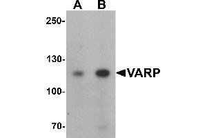 Western blot analysis of VARP in K562 cell lysate with VARP antibody at (A) 1 and (B) 2 µg/mL. (ANKRD27 anticorps  (N-Term))