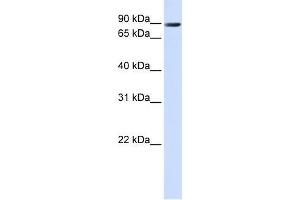 Human 293T; WB Suggested Anti-TMEM16K Antibody Titration: 0. (Anoctamin 10 anticorps  (C-Term))