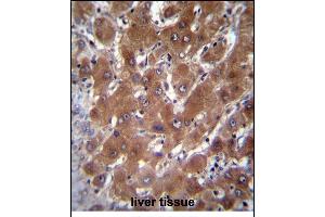 GBA3 Antibody (C-term) (ABIN656223 and ABIN2845539) immunohistochemistry analysis in formalin fixed and paraffin embedded human liver tissue followed by peroxidase conjugation of the secondary antibody and DAB staining. (GBA3 anticorps  (C-Term))