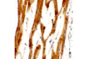Immunohistochemical anyalysis of human heart tissue with FCHO2 polyclonal antibody  at 2. (FCHO2 anticorps  (Internal Region))