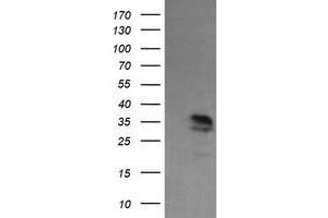 Image no. 2 for anti-Kinesin Family Member 25 (KIF25) antibody (ABIN1499040) (KIF25 anticorps)
