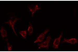 ABIN6276801 staining Hela cells by IF/ICC. (GRK2 anticorps  (Internal Region))