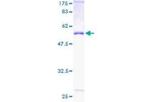 Image no. 1 for Proteasome (Prosome, Macropain) 26S Subunit, Non-ATPase, 9 (PSMD9) (AA 1-223) protein (GST tag) (ABIN1316659)