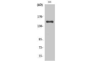 Western Blotting (WB) image for anti-Collagen, Type IV, alpha 3 (COL4A3) (cleaved), (Leu1425) antibody (ABIN6285759) (COL4a3 anticorps  (cleaved, Leu1425))