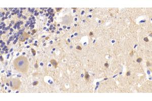 Detection of MAP2 in Human Cerebellum Tissue using Polyclonal Antibody to Microtubule Associated Protein 2 (MAP2)