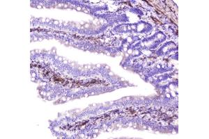 IHC analysis of Hsp27 using anti-Hsp27 antibody (ABIN6719322).