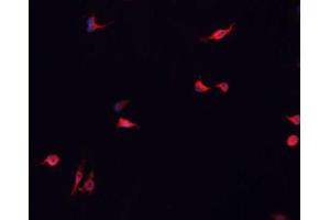 ABIN6266838 staining MCF-7 cells by IF/ICC. (DUSP16 anticorps  (Internal Region))