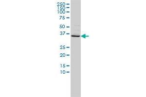 FOXR2 monoclonal antibody (M01), clone 2C1 Western Blot analysis of FOXR2 expression in Hela . (FOXR2 anticorps  (AA 1-311))
