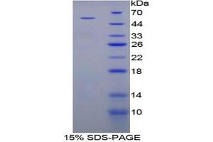 SDS-PAGE of Protein Standard from the Kit  (Highly purified E.