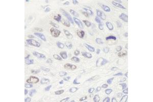 anti-Topo IIalpha (C-Term) antibody