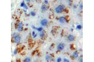 Used in DAB staining on fromalin fixed paraffin-embedded Liver tissue