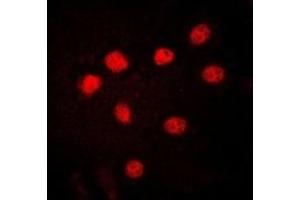 Immunofluorescent analysis of HMGB1 staining in HuvEc cells. (HMGB1 anticorps)