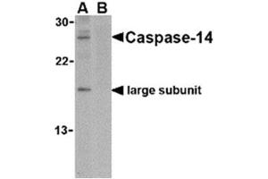 Image no. 1 for anti-Caspase 14, Apoptosis-Related Cysteine Peptidase (CASP14) (C-Term) antibody (ABIN318746) (CASP14 anticorps  (C-Term))