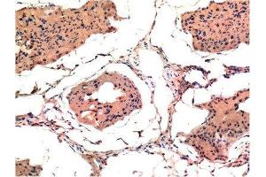 Immunohistochemical analysis of paraffin-embedded Rat Testis Tissue using Bax Mouse mAb diluted at 1:200. (BAX anticorps)