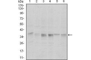 Western blot analysis using PPP1CA mouse mAb against Hela (1), HepG2 (2), MCF-7 (3), Jurkat (4) and A549 (5) cell lysate.