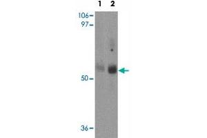 Western blot analysis of MFSD2 in rat lung tissue lysate with MFSD2 polyclonal antibody  at (1) 1 and (2) 2 ug/mL. (MFSD2A anticorps  (C-Term))