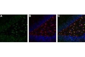 Expression of TrkA in rat brain hippocampal dentate gyrus - Immunohistochemical staining of immersion-fixed, free floating rat brain frozen sections.