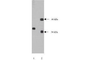 Lane 1. (NPDC1 anticorps)
