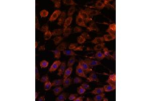 Immunofluorescence analysis of L929 cells using TENM1 antibody (ABIN7270767) at dilution of 1:100. (ODZ1/Teneurin 1 anticorps  (AA 350-540))