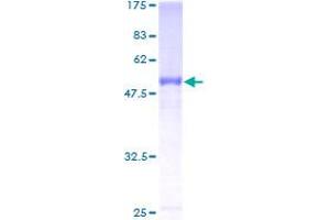 Image no. 1 for Complement Factor H-Related 2 (CFHR2) (AA 19-270) protein (GST tag) (ABIN1349211)