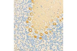 Immunohistochemistry analysis of paraffin embedded rat cerebellum using HOMER3 (ABIN7074257) at dilution of 1: 2100