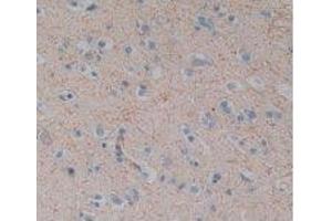 IHC-P analysis of Human Brain Tissue, with DAB staining. (Substance P anticorps)