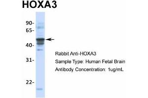 Host:  Rabbit  Target Name:  HOXA3  Sample Type:  Human Fetal Brain  Antibody Dilution:  1. (HOXA3 anticorps  (C-Term))