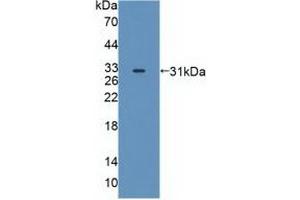 Western blot analysis of recombinant Human MAPK12. (MAPK12 anticorps  (AA 27-311))