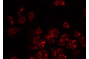 ABIN6274721 staining Hela by IF/ICC. (MRPS35 anticorps  (N-Term))