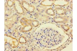 Immunohistochemistry of paraffin-embedded human kidney tissue using ABIN7174731 at dilution of 1:100 (PARP11 anticorps  (AA 1-245))
