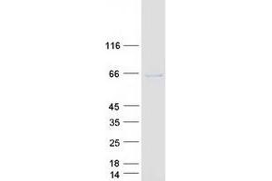 Validation with Western Blot