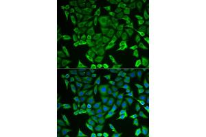 Immunofluorescence (IF) image for anti-Arginyl-tRNA Synthetase (RARS) antibody (ABIN1980323) (RARS anticorps)