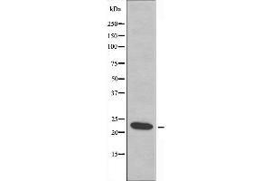 Western blot analysis of extracts from Jurkat cells, using ASF1A antibody. (ASF1A anticorps  (Internal Region))