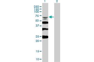 Western Blot analysis of RMI1 expression in transfected 293T cell line by RMI1 MaxPab polyclonal antibody. (RMI1 anticorps  (AA 1-470))
