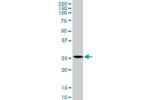 BCAP31 monoclonal antibody (M01), clone 3C5. (BCAP31 anticorps  (AA 137-246))