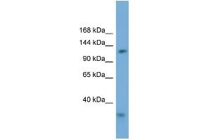 WB Suggested Anti-RFC1 Antibody Titration: 0. (RFC1 anticorps  (Middle Region))