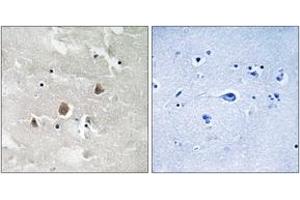 Immunohistochemistry analysis of paraffin-embedded human brain, using MAP3K1 (Phospho-Thr1402) Antibody. (MAP3K1 anticorps  (pThr1402))