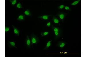Immunofluorescence of monoclonal antibody to CRSP6 on HeLa cell. (MED17 anticorps  (AA 551-651))
