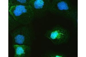 IF analysis of GAL4 using anti-GAL4 antibody (ABIN4886660).