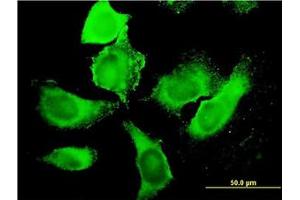 Image no. 3 for anti-phosphoinositide Kinase, FYVE Finger Containing (PIKFYVE) (AA 342-452) antibody (ABIN599337) (PIKFYVE anticorps  (AA 342-452))