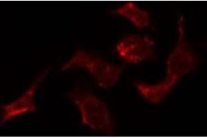 ABIN6278567 staining HepG2 by IF/ICC. (ELAV2/4 anticorps)