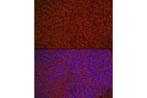 Immunofluorescence analysis of rat brain cells using Aquaporin-4  Rabbit pAb (ABIN3016920, ABIN3016921, ABIN3016922 and ABIN6219881) at dilution of 1:50 (40x lens).