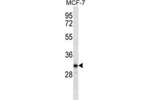 TESSP1 Antibody (Center) western blot analysis in MCF-7 cell line lysates (35 µg/lane). (TESSP1 anticorps  (Middle Region))