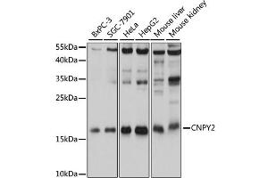 Western blot analysis of extracts of various cell lines, using CNPY2 antibody. (CNPY2/MSAP anticorps)