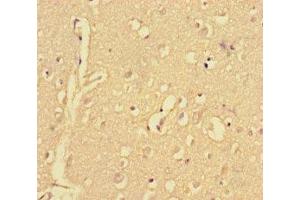 Immunohistochemistry of paraffin-embedded human brain tissue using ABIN7148515 at dilution of 1:100