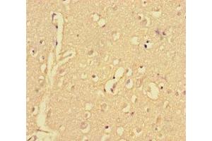 Immunohistochemistry of paraffin-embedded human brain tissue using ABIN7148515 at dilution of 1:100 (Copine II anticorps  (AA 1-300))