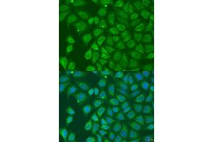 Immunofluorescence analysis of U2OS cells using HOXD10 antibody (ABIN2736912) at dilution of 1:100.